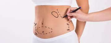 lipo4