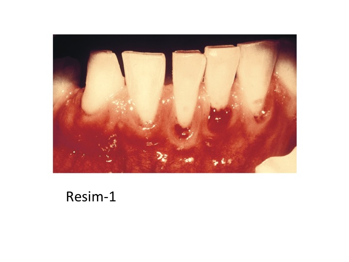 DİABET_RESİM-1.jpg