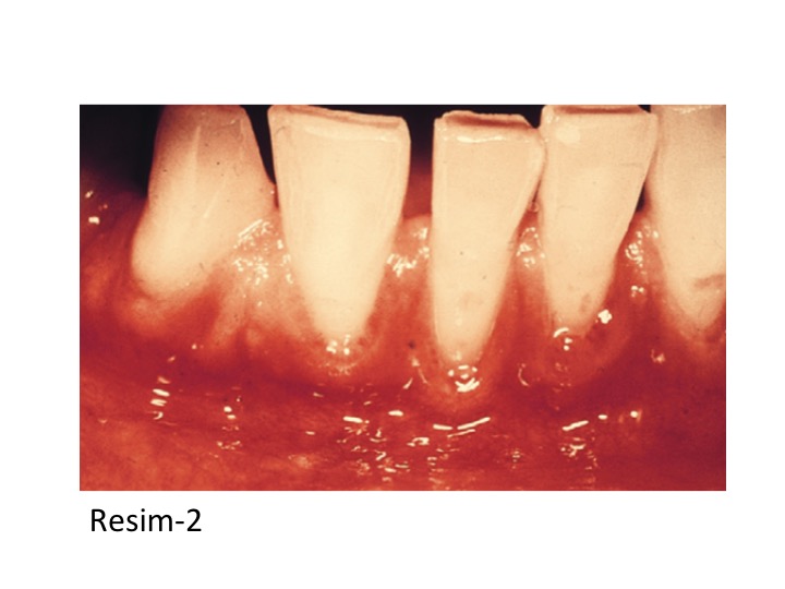 DİABET_RESİM-2.jpg
