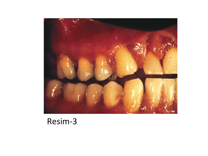 DİABET_RESİM-3.jpg