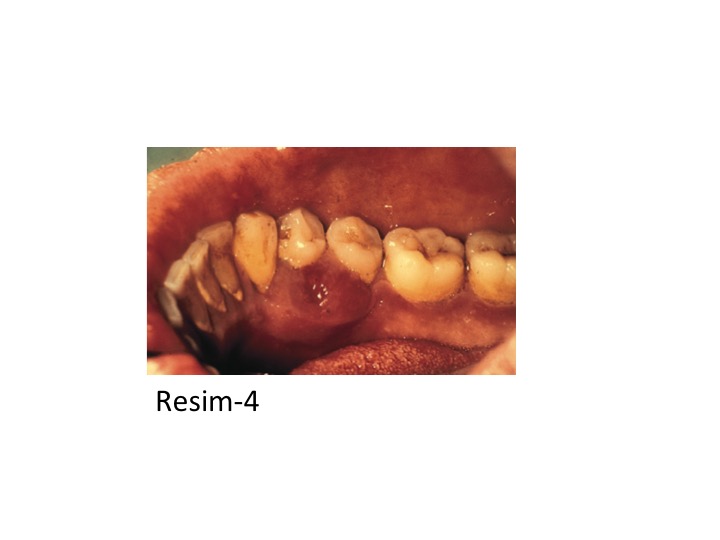 DİABET_RESİM-4.jpg