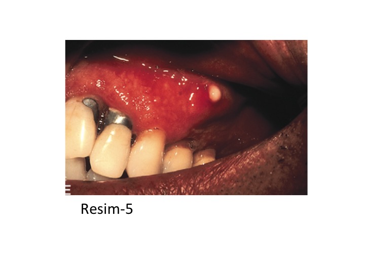 DİABET_RESİM-5_1.jpg