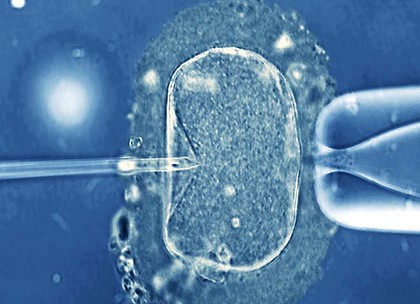 a64bipad art wide IVF 420x0