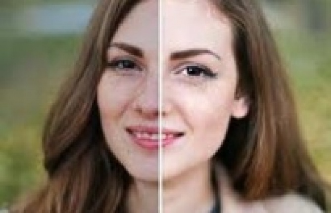 genclik_estetik2.jpg