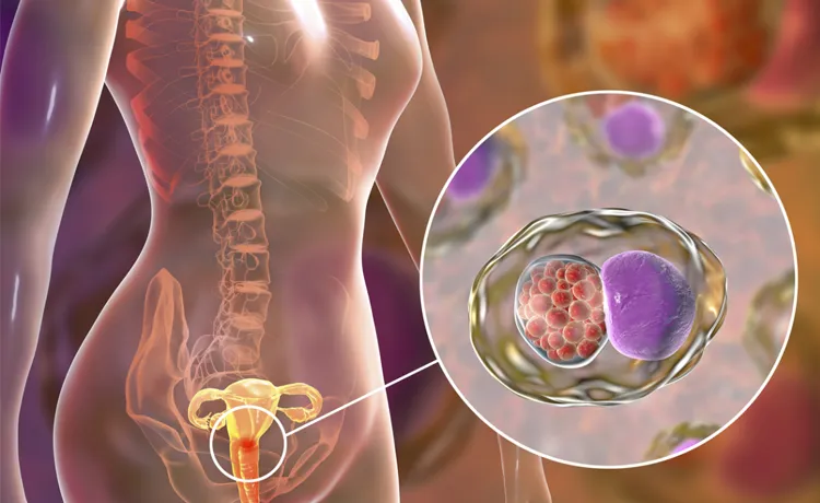 hpv.webp